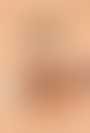 کاج مخروطی