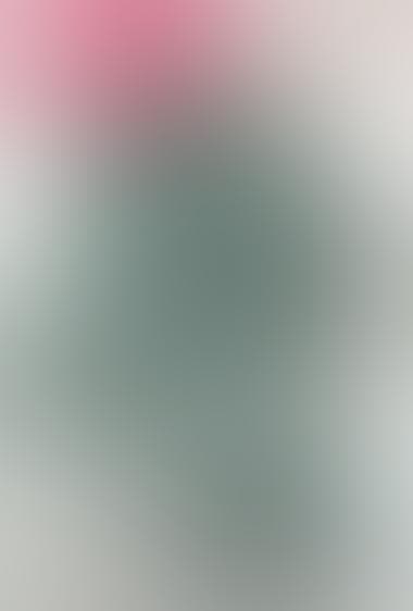 تعصب